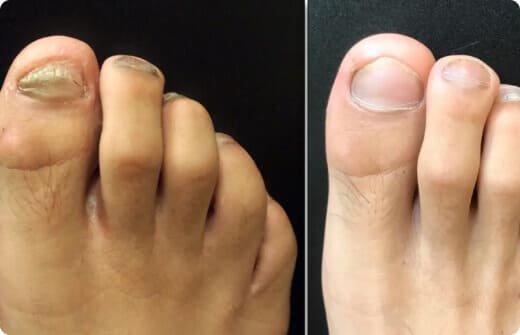 Mais um depoimento positivo sobre ClearNail